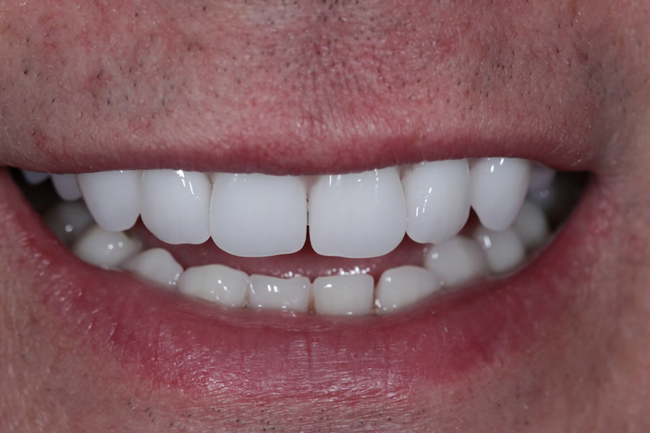 dentures magherafelt