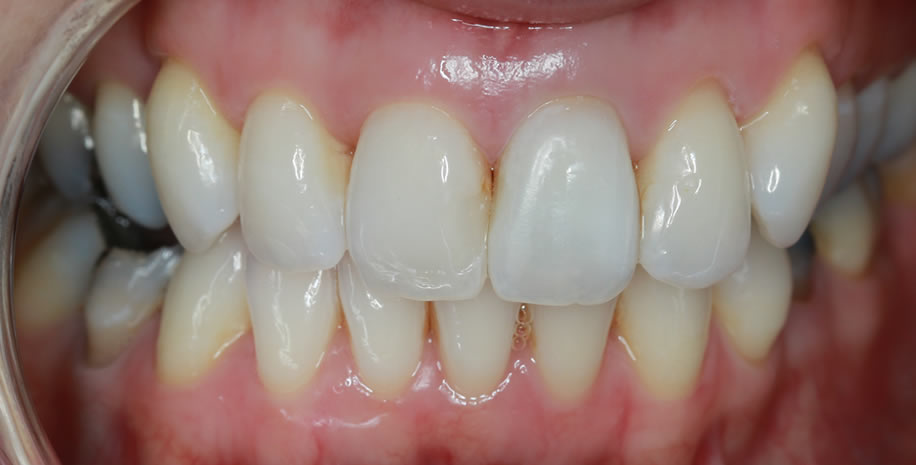 dentures magherafelt