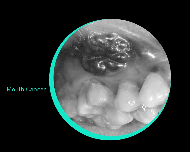 oral health